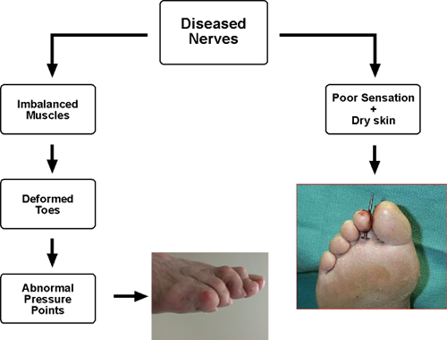 foot problems2